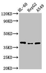 MCU Antibody in Western Blot (WB)