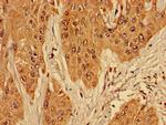 RPL10L Antibody in Immunohistochemistry (Paraffin) (IHC (P))