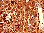 RPL10L Antibody in Immunohistochemistry (Paraffin) (IHC (P))