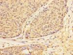 USP28 Antibody in Immunohistochemistry (Paraffin) (IHC (P))