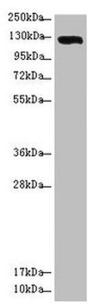 USP28 Antibody in Western Blot (WB)