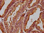 MICAL1 Antibody in Immunohistochemistry (Paraffin) (IHC (P))