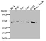 MR1 Antibody in Western Blot (WB)