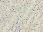 DDX11 Antibody in Immunohistochemistry (Paraffin) (IHC (P))