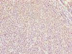 DDX11 Antibody in Immunohistochemistry (Paraffin) (IHC (P))