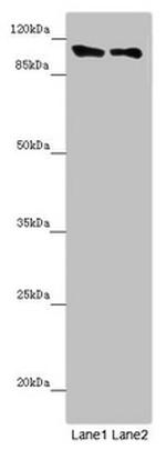 DDX11 Antibody in Western Blot (WB)