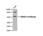 LEMD2 Antibody in Western Blot (WB)