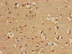 CPT1C Antibody in Immunohistochemistry (Paraffin) (IHC (P))