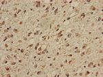 CPT1C Antibody in Immunohistochemistry (Paraffin) (IHC (P))