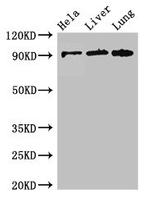 CPT1C Antibody in Western Blot (WB)