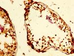 RAP80 Antibody in Immunohistochemistry (Paraffin) (IHC (P))