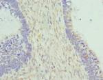 Cytohesin 2 Antibody in Immunohistochemistry (Paraffin) (IHC (P))