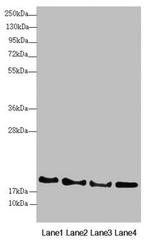 RNF5 Antibody in Western Blot (WB)