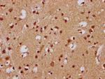 FEV Antibody in Immunohistochemistry (Paraffin) (IHC (P))