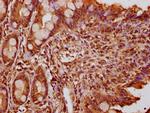 FEV Antibody in Immunohistochemistry (Paraffin) (IHC (P))