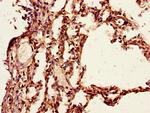 PAIP2 Antibody in Immunohistochemistry (Paraffin) (IHC (P))