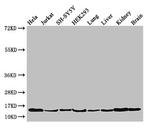 PAIP2 Antibody in Western Blot (WB)