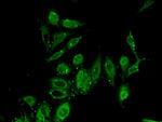 PITX2 Antibody in Immunocytochemistry (ICC/IF)