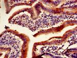 PITX2 Antibody in Immunohistochemistry (Paraffin) (IHC (P))