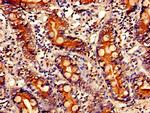 PITX2 Antibody in Immunohistochemistry (Paraffin) (IHC (P))