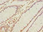 NAPG Antibody in Immunohistochemistry (Paraffin) (IHC (P))