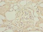 NAPG Antibody in Immunohistochemistry (Paraffin) (IHC (P))