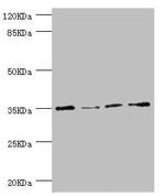 NAPG Antibody in Western Blot (WB)