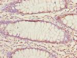 EYA3 Antibody in Immunohistochemistry (Paraffin) (IHC (P))