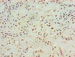 Aminoacylase Antibody in Immunohistochemistry (Paraffin) (IHC (P))