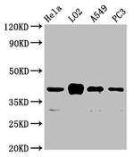 VN1R1 Antibody in Western Blot (WB)