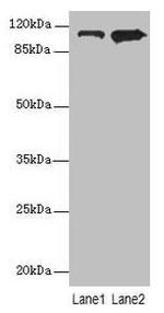 MOV10 Antibody in Western Blot (WB)