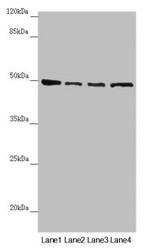 AP1M1 Antibody in Western Blot (WB)