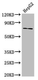 ABCG5 Antibody in Western Blot (WB)