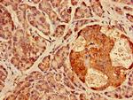 AGPAT3 Antibody in Immunohistochemistry (Paraffin) (IHC (P))