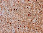 CPNE7 Antibody in Immunohistochemistry (Paraffin) (IHC (P))