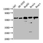 CPNE7 Antibody in Western Blot (WB)