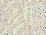 SKIP Antibody in Immunohistochemistry (Paraffin) (IHC (P))