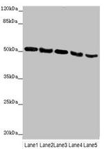 SKIP Antibody in Western Blot (WB)