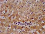 AGXT2 Antibody in Immunohistochemistry (Paraffin) (IHC (P))