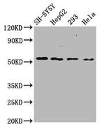 SLC19A3 Antibody in Western Blot (WB)