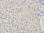 MCCC2 Antibody in Immunohistochemistry (Paraffin) (IHC (P))