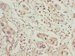 MCCC2 Antibody in Immunohistochemistry (Paraffin) (IHC (P))