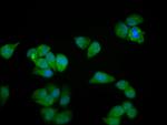 MYOZ2 Antibody in Immunocytochemistry (ICC/IF)