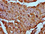 MYOZ2 Antibody in Immunohistochemistry (Paraffin) (IHC (P))