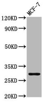 MYOZ2 Antibody in Western Blot (WB)