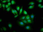 WWOX Antibody in Immunocytochemistry (ICC/IF)