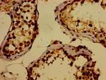 WWOX Antibody in Immunohistochemistry (Paraffin) (IHC (P))