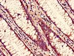 NUP85 Antibody in Immunohistochemistry (Paraffin) (IHC (P))