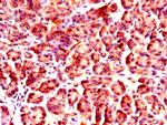 NUP85 Antibody in Immunohistochemistry (Paraffin) (IHC (P))