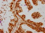 SAV1 Antibody in Immunohistochemistry (Paraffin) (IHC (P))